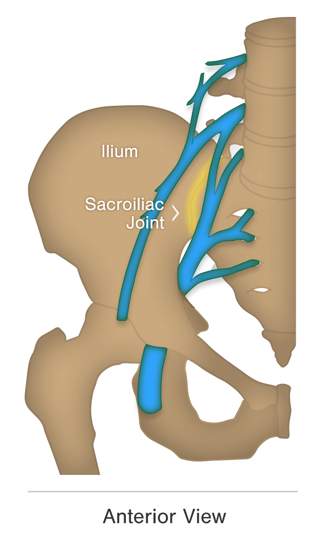 is-your-sciatica-coming-from-your-spine-or-your-si-joint-carolina